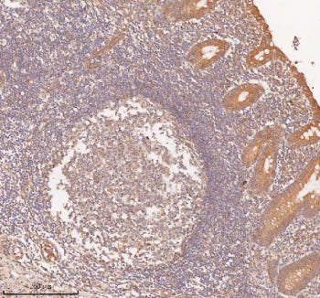 IHC analysis of SAMD9L using anti-SAMD9L antibody. SAMD9L was detected in a paraffin-embedded sectio