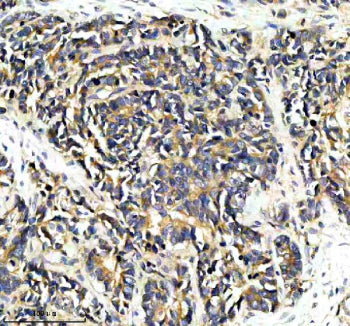 Immunohistochemical staining of PPP2R5E using anti-PPP2R5E antibody. PPP2R5E was detected in a paraf
