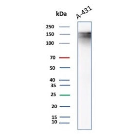 Western blot testing of A431 lysate using Epidermal Growth Factor Receptor antibody. Expected molecu