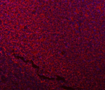 NDUFB7 Antibody