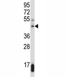 SUV39H1 antibody western blot analysis in 293 lysate.