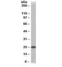 Western blot testing of HeLa lysate with TMS1 antibody at 1ug/ml. Predicted molecular weight ~22 kDa