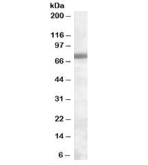 Western blot testing of Jurkat lysate with EXOSC9 antibody at 0.3ug/ml. Predicted molecular weight: