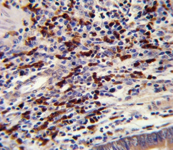 CNOT8 Antibody / CCR4-NOT transcription complex subunit 8