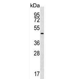 Western blot testing of human K562 cell lysate with Gastric Intrinsic Factor antibody. Predicted mol