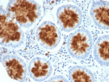 IHC staining of FFPE human colon tissue with NTRK2 antibody (clone NTRK2/4672). HIER: boil tissue se