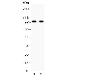 Western blot testing of GLUR4 antibody and Lane 1: rat brain; 2: mouse brain lysate. Predicted/obser