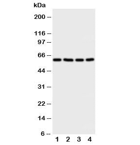 Western blot testing of RIP2 antibody and Lane 1: A549; 2: HeLa; 3: PANC; 4: COLO320 cell lysate. Pr