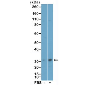 Western blot testing of lysate of human MCF-7 cells, non-treated (-) or treated (+) with fetal bovin
