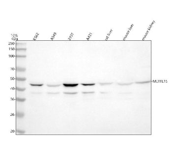 Western blot analysis of METTL15 using anti-METTL15 antibody. Lane 1: human K562 whole cell lysates,