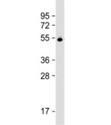 Western blot testing of human plasma lysate with Vitamin D binding protein antibody at 1:2000. Predi