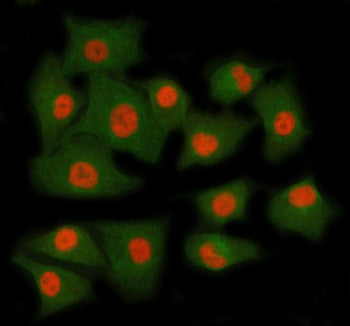 Immunofluorescent staining of RING1 using anti-RING1 antibody (red) and anti-Beta Tubulin antibody (