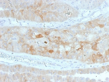 IHC staining of FFPE human kidney with ROR2 antibody. HIER: boil tissue sections in pH 9 10mM Tris w
