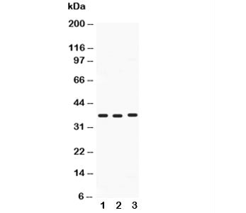 Western blot testing of Midkine antibody and Lane 1: HeLa; 2: SMMC-7721; 3: SW620; Predicted size: 1