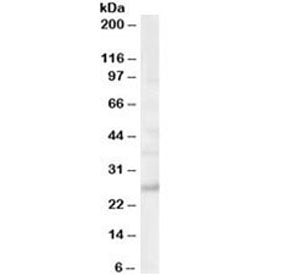 Western blot testing of human brain lysate with MOG antibody at 0.03ug/ml. Expected molecular weight