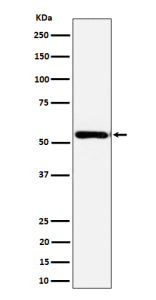 Western blot analysis of AER61 expression in human Caco 2 cell lysate using EOGT antibody. EOGT (~62