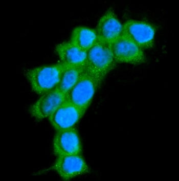 Immunofluorescent staining of FFPE human MCF7 cells with AlaRS antibody (green) and DAPI nuclear sta