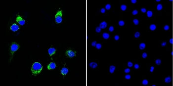 Lambda Light Chain Antibody / Lambda Antibody