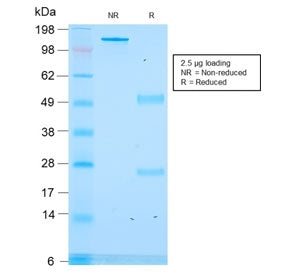 CLIP Antibody / ACTH