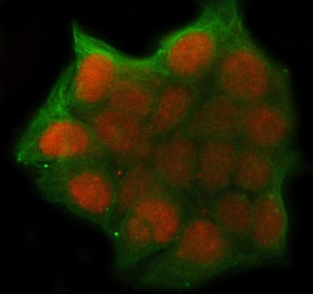 Immunofluorescent staining of FFPE human MCF7 cells with GNB1 antibody (red) and Alpha Tubulin mAb (