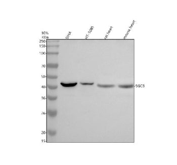 Western blot analysis of Beta Sarcoglycan/SGCB using anti-SGCB antibody. Electrophoresis was perform