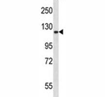 Epha2 antibody western blot analysis in mouse lung tissue lysate. Expected molecular weight: 108~130