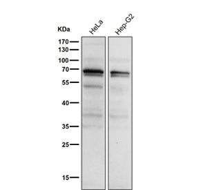 All lanes use the Phospho-PKC alpha (Thr497) antibody at 1:1K dilution for 1 hour at room temperatur