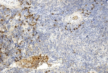 IHC staining of FFPE mouse spleen tissue with GREM1 antibody. HIER: steam section in pH6 citrate buf