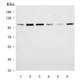 Western blot testing of 1) human U-87 MG, 2) human SH-SY5Y, 3) human HeLa, 4) human MCF7, 5) rat bra