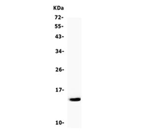 Western blot testing of human K562 cell lysate with CSTA antibody. Predicted molecular weight ~11 kD