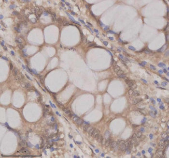 Immunohistochemical staining of OAZ1 using anti-OAZ1 antibody. OAZ1 was detected in a paraffin-embed