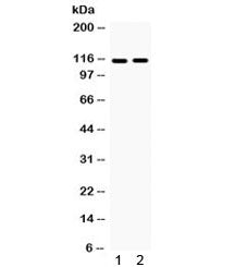 Eph Receptor A5 Antibody / EphA5