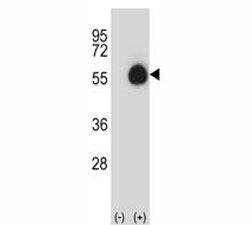 Western blot analysis of CD33 antibody and 293 cell lysate (2 ug/lane) either nontransfected (Lane 1