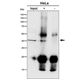 Immunoprecipitation of ACAT1 protein from 500ug of human K562 whole cell lysate with ACAT1 antibody at 1:50. Western blot testing was done at 1:1000.