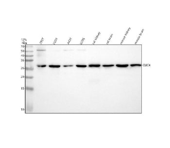 Western blot analysis of CLIC4 using anti-CLIC4 antibody. Lane 1: human 293T whole cell lysates, Lan