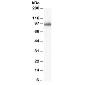 Western blot testing of Daudi cell lysate with Importin beta antibody at 0.03ug/ml. Predicted molecu
