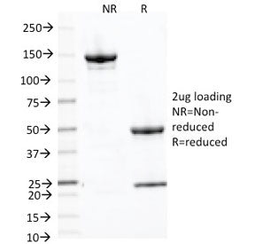 SDS-PAGE analysis of purified, BSA-free Placental Alkaline Phosphatase antibody (clone ALP/870) as c