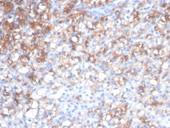 HSP27 Antibody / HSPB1