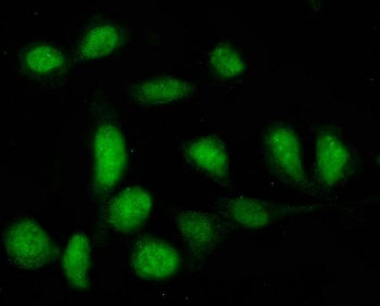 PTPN22 Antibody / Protein tyrosine phosphatase non-receptor type 22