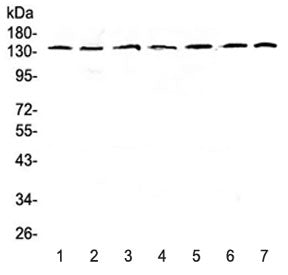 Western blot testing of human 1) HeLa, 2) COLO320, 3) A549, 4) SK-OV-3, 5) A431, 6) rat brain and 7)