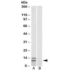 Western blot testing of human gastrointestinal cancer lysate and p15 INK4b antibody at 1ug/ml with [