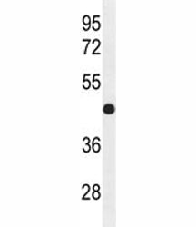 IRF2 antibody western blot analysis in mouse bladder tissue lysate. Estimated molecular weight: ~39k