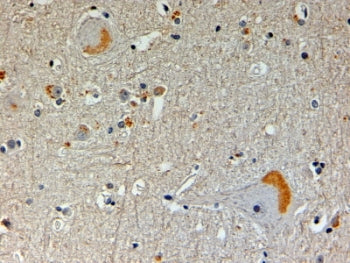 IHC testing of FFPE human brain with NOS1AP antibody at 4ug/ml. HIER: steamed with pH9 Tris/EDTA buf