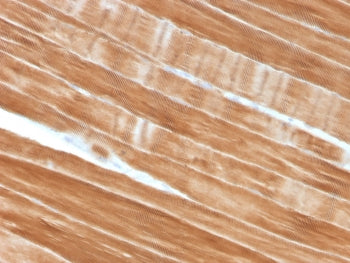 IHC staining of FFPE human skeletal muscle tissue with Sarcomeric Alpha Actinin antibody (clone ACTN