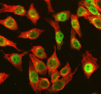 Immunofluorescent staining of FFPE human HeLa cells with OGG1 antibody (green) and Alpha Tubulin mAb