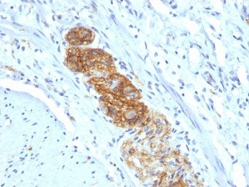 NCAM / CD56 Antibody