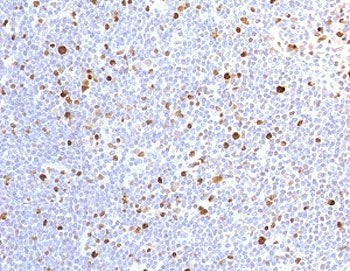 IHC testing of FFPE human lymph node with recombinant MCM7 antibody (clone MMCC7-1R). Required HIER: