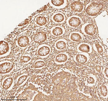 Immunohistochemical staining of NUP43 using anti-NUP43 antibody. NUP43 was detected in a paraffin-em