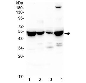 Western blot testing of 1) rat liver, 2) rat kidney, 3) rat lung and 4) mouse liver lysate with ASL