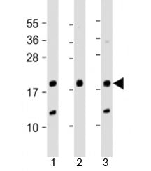 THRSP Antibody / Thyroid hormone-inducible hepatic protein